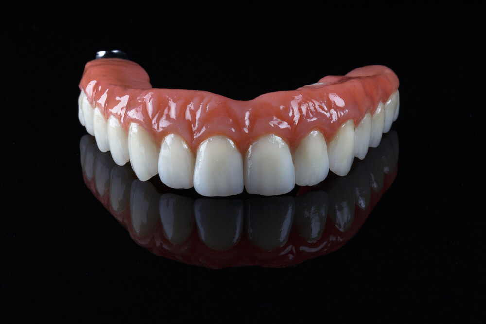 CUSTOM DENTURES FOR A NATURAL LOOK