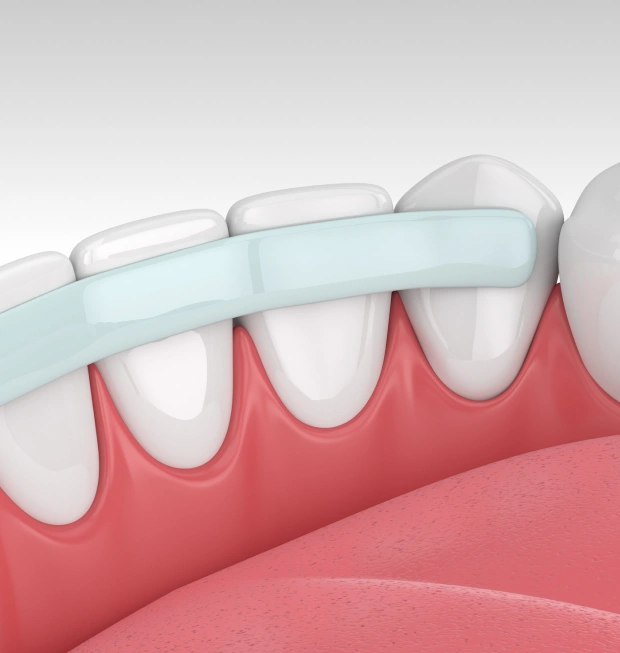 A Simple Way to Enhance Your Smile