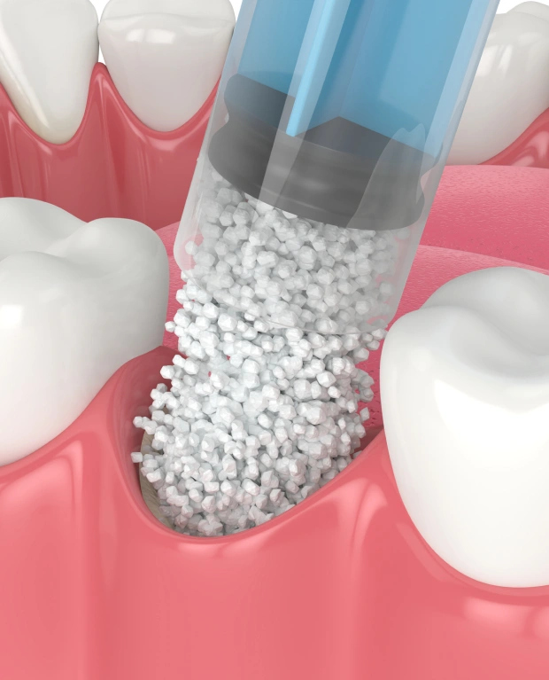 Building a Strong Foundation for Your Smile