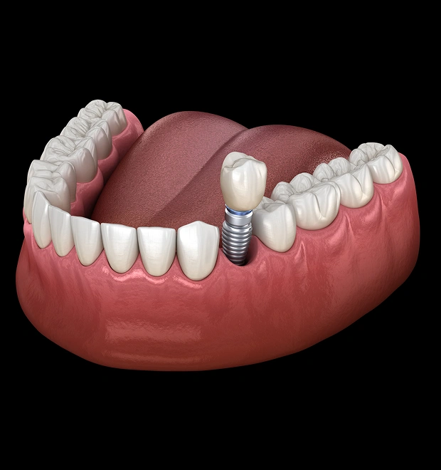 Starting Your Smile Journey